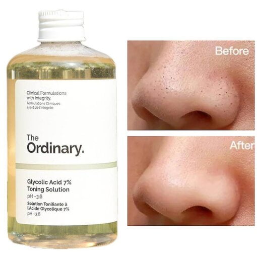 The Ordinary Glycolic Acid 7% Toning Solution – Exfoliating Face Toner For Radiant Skin, Removes Dead Skin Cells, Brightens & Smoothens, 240ml