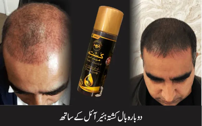 Kushta Herbal Hair Oil For Long And Healthy Hair 120m